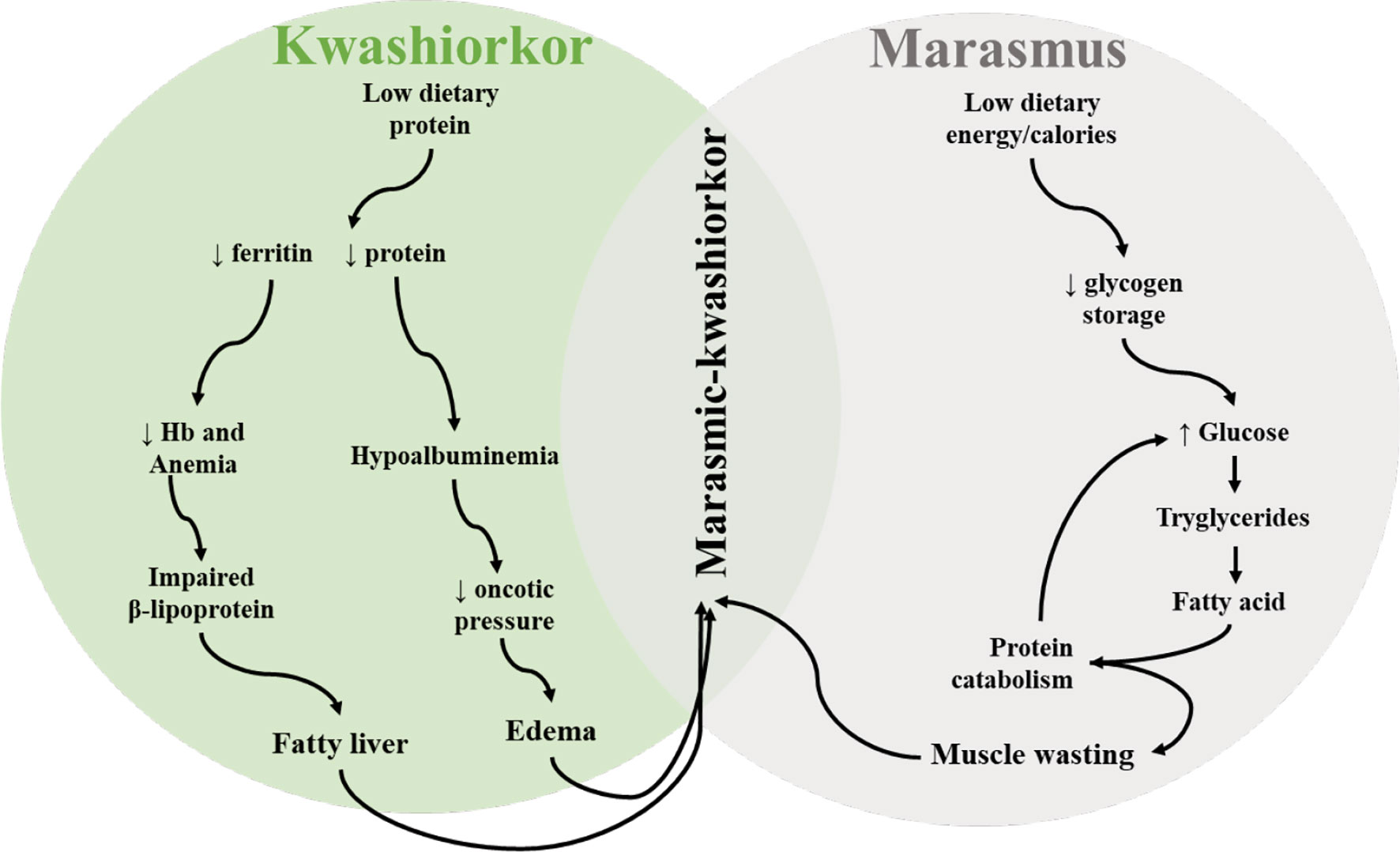 Kwashiorkor - Clinical Presentation